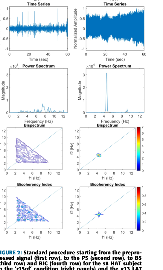 Bispectral analysis of Parkinsonian tremor figure