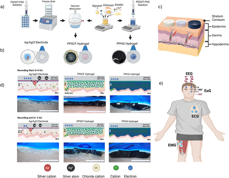 Conductive hydrogel electrode figure